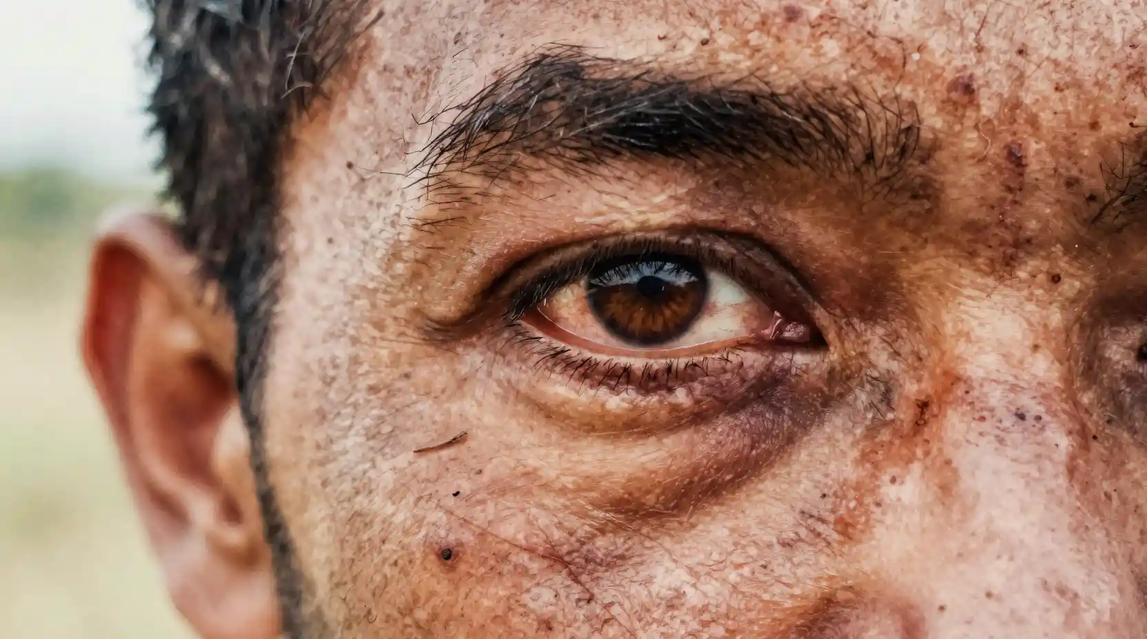 Weathered male eye in extreme close up with scars